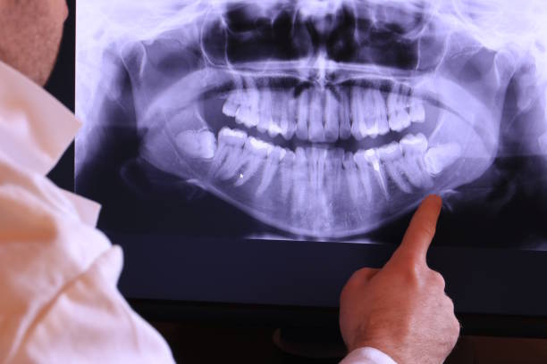 Best Pediatric Emergency Dentist in City View, SC